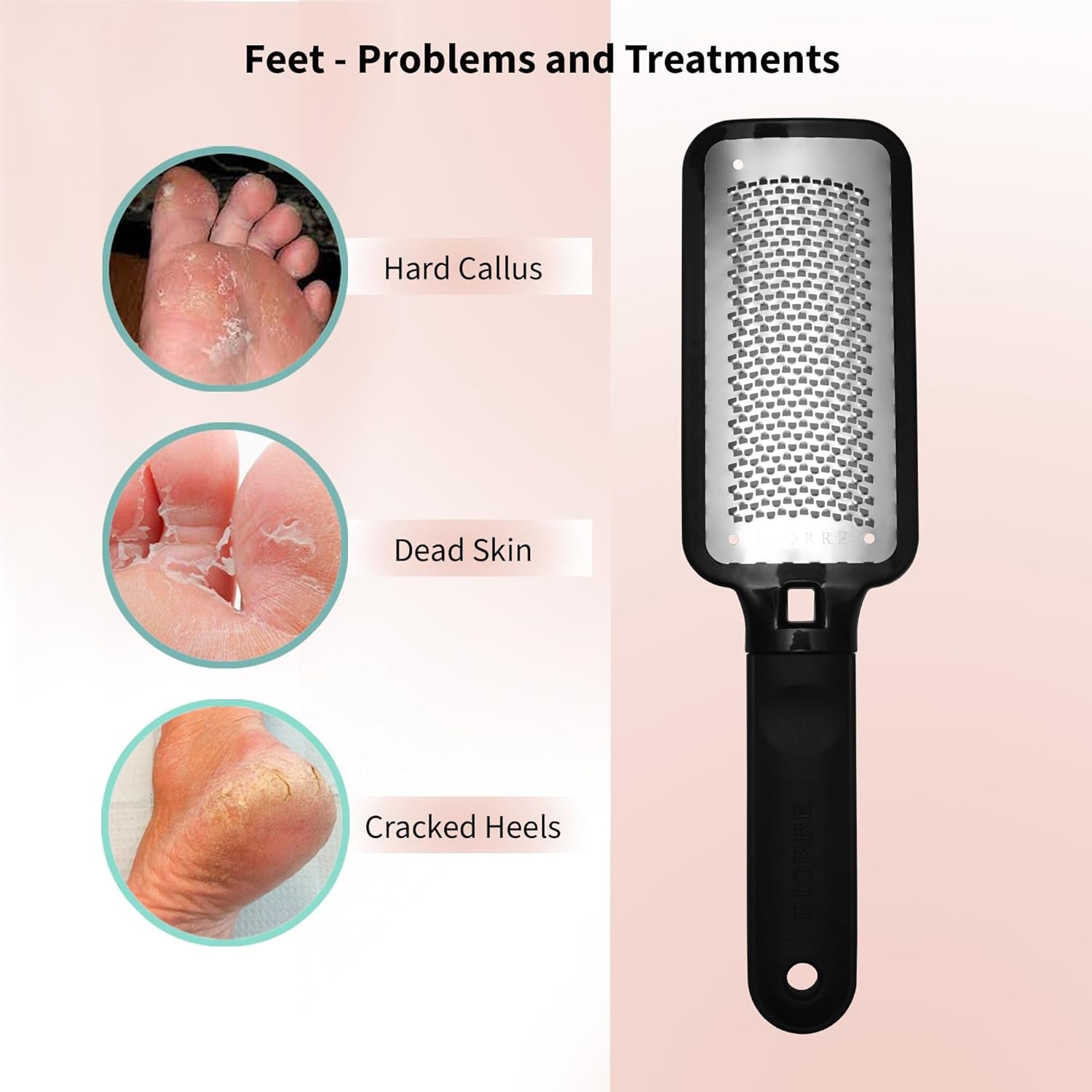 Professional Foot Scrubber for Hard Skin - Foot File, Foot Scraper & Callus Remover for Feet Leaving Soft & Smooth Heels (Foot Rasp, Pack 1)